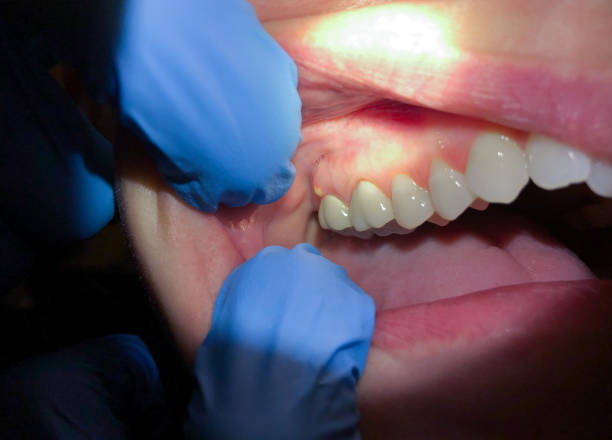 Best Urgent Tooth Repair  in Tripoli, IA