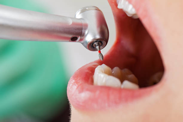 Best Emergency Gum Pain Relief  in Tripoli, IA